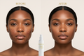 Dark Spot Cream – Before & After