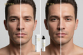 Hyaluronic Acid Face Cream for Men – Before & After