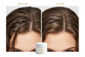 Scalp Scrub – Before & After