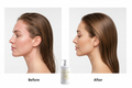 Sensitive Scalp Shampoo – Before & After